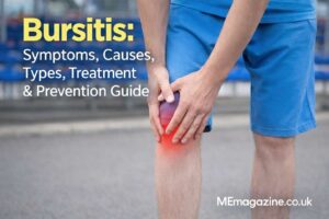 Bursiter: Symptoms, Causes, Types, Treatment & Prevention Guide