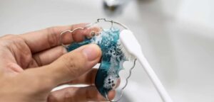 Common Mistakes People Make While Cleaning Retainers