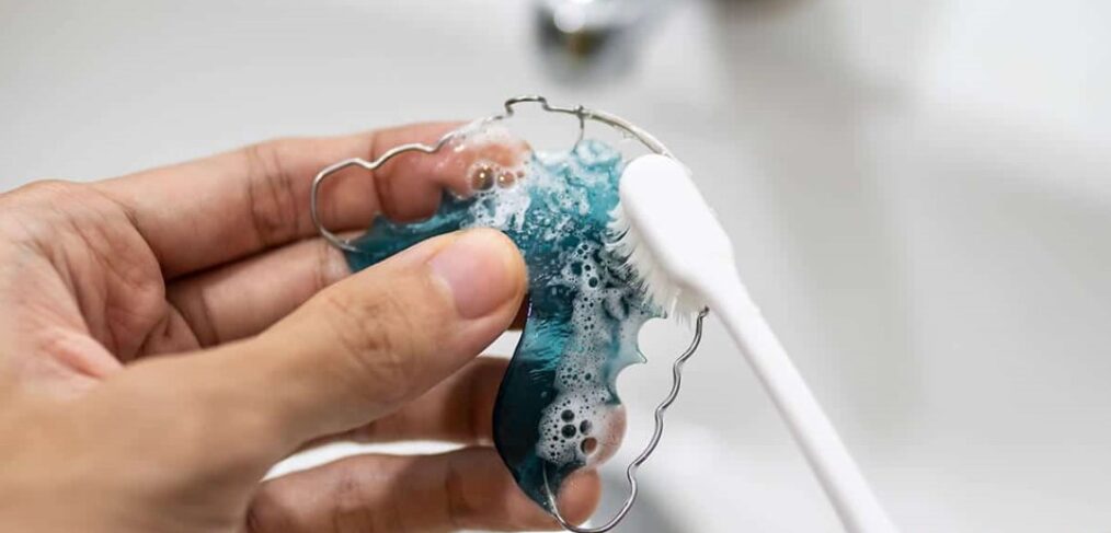 Common Mistakes People Make While Cleaning Retainers